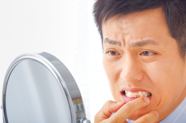 30〜50代が歯を失いやすい主な原因
