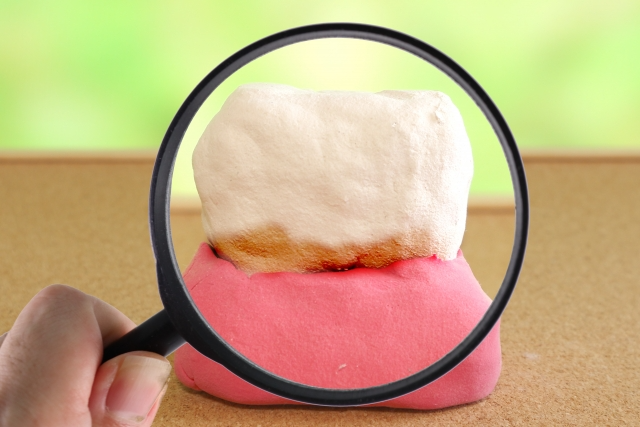 大分市の福﨑歯科で受けられる歯周病治療